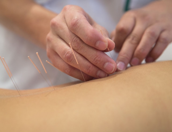 Go to Acupuncture: An Introduction